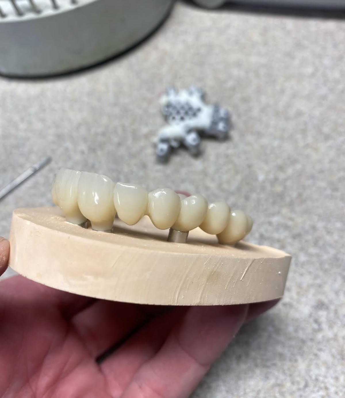 The Dental Lab photo 5