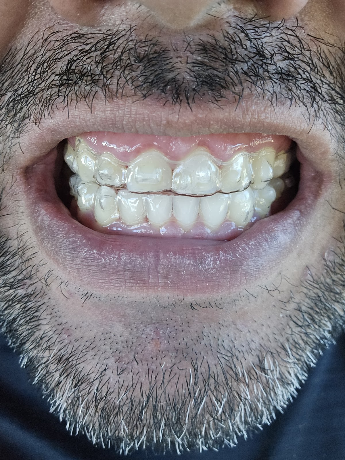 California Smile photo 4