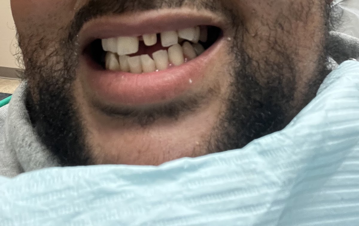 Aspen Dental - Plymouth photo 2