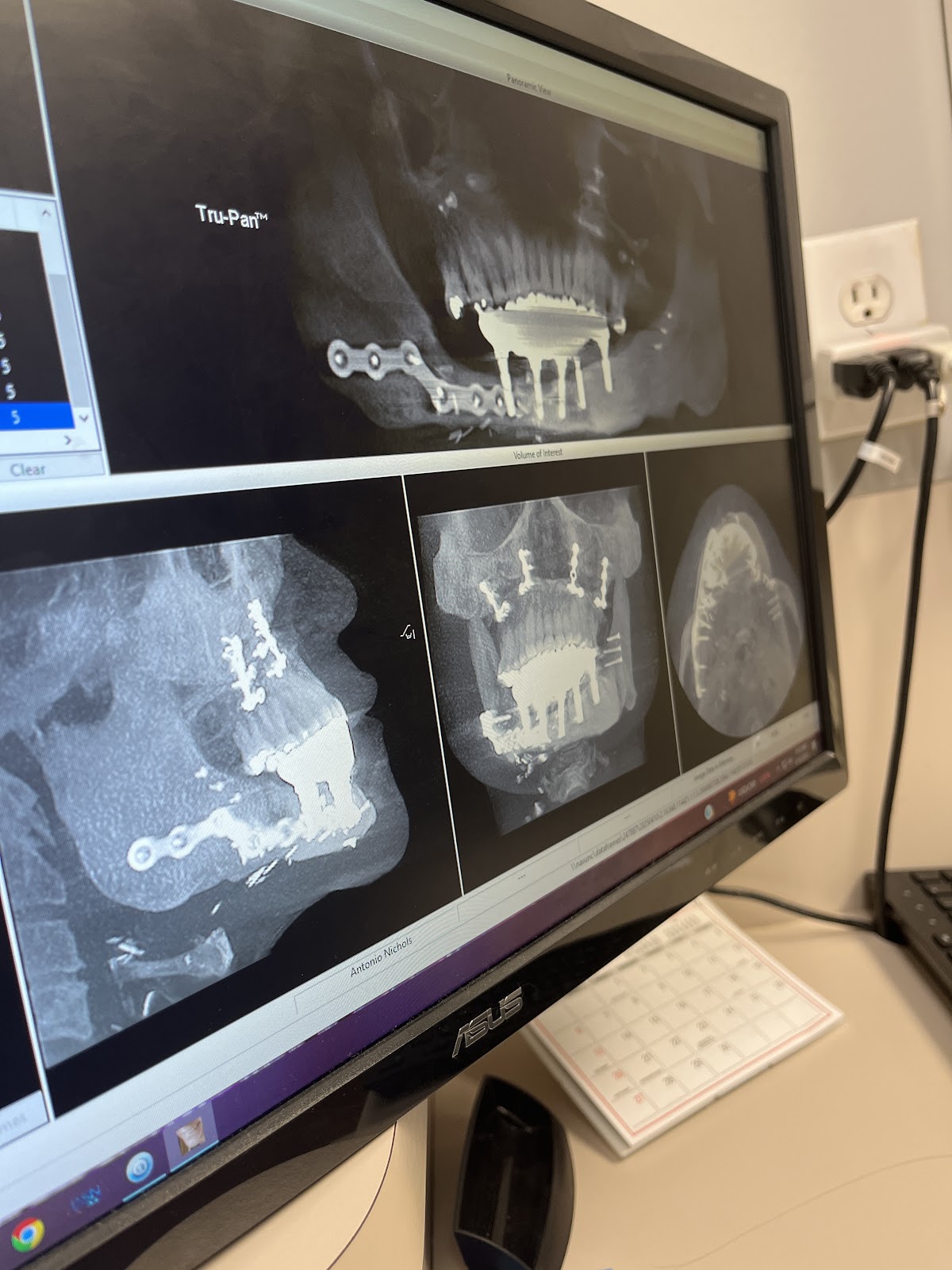 Carolinas Center for Oral & Facial Surgery photo 5
