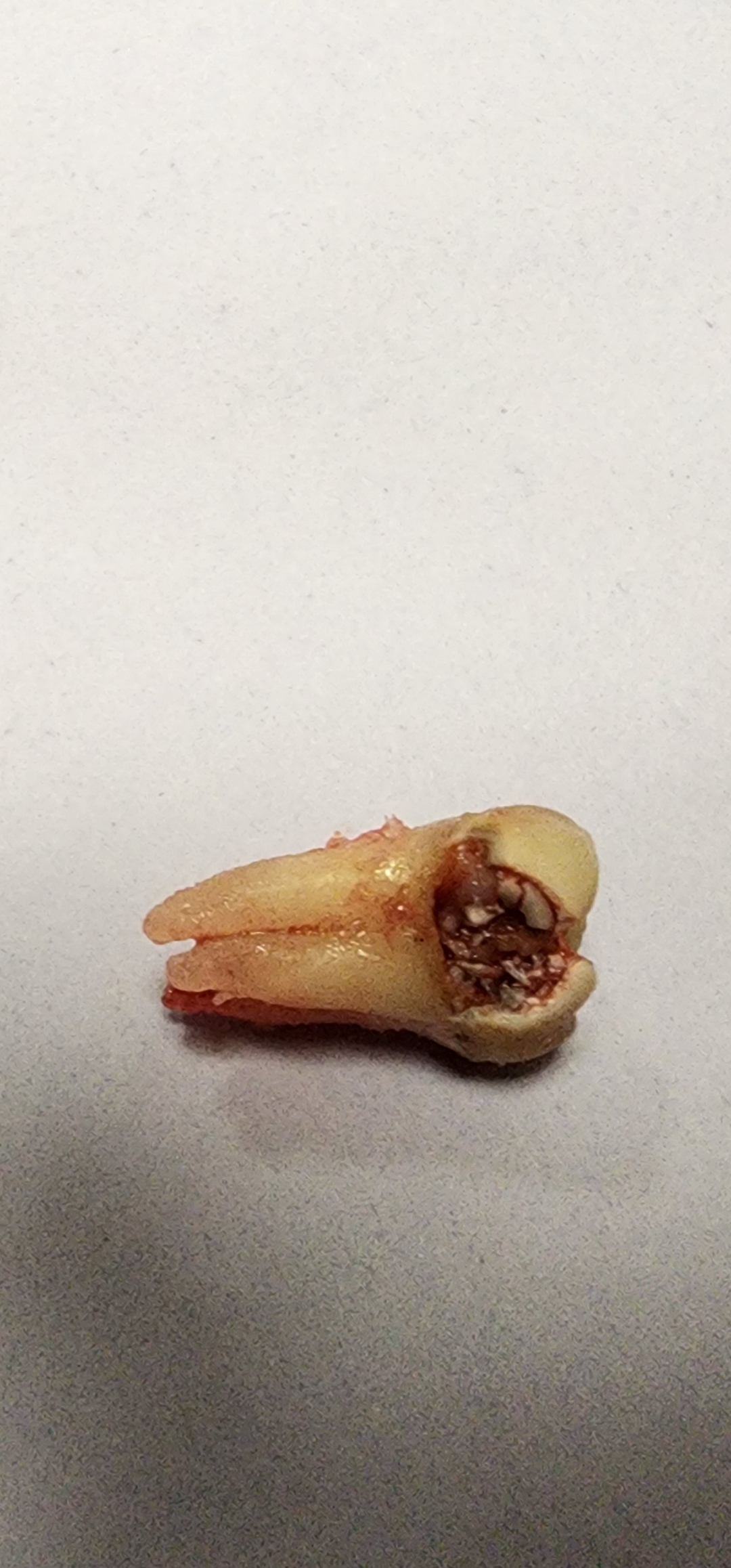 Aspen Dental - Uniontown photo 4