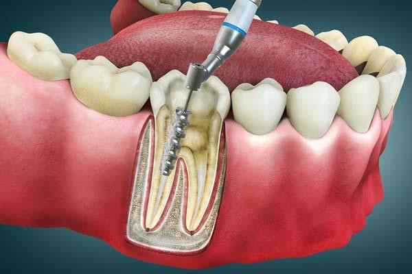 Dentist in Cedar City | Eggen Dental photo 4