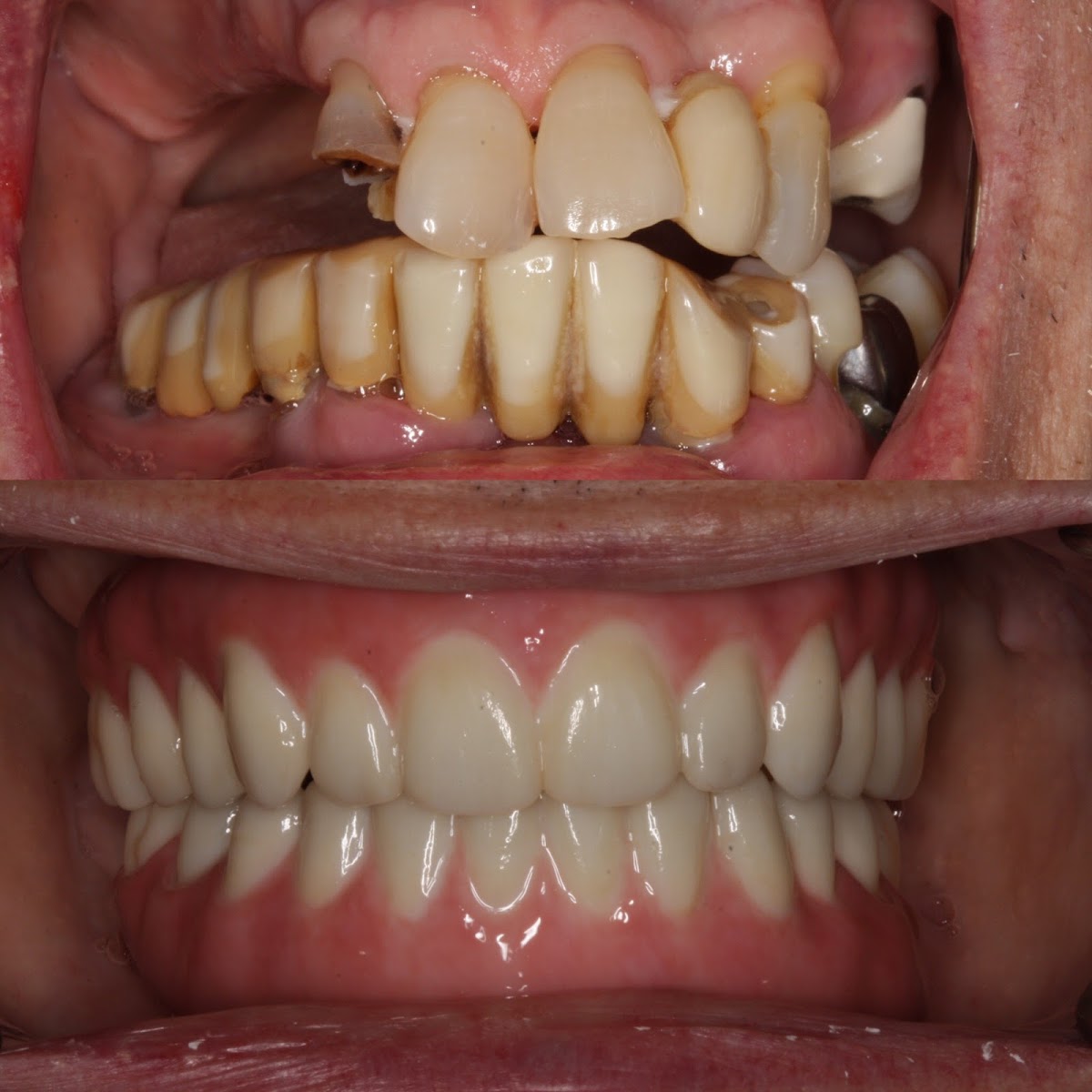 Southern Dental Implant Center photo 3