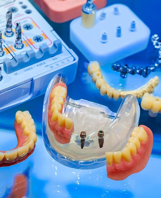 Southern Dental Implant Center photo 5