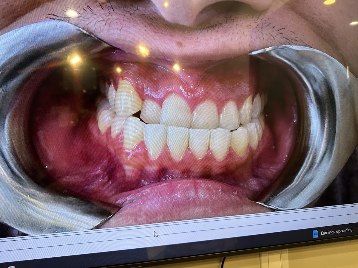Ace Dental Center - Lombard photo 5