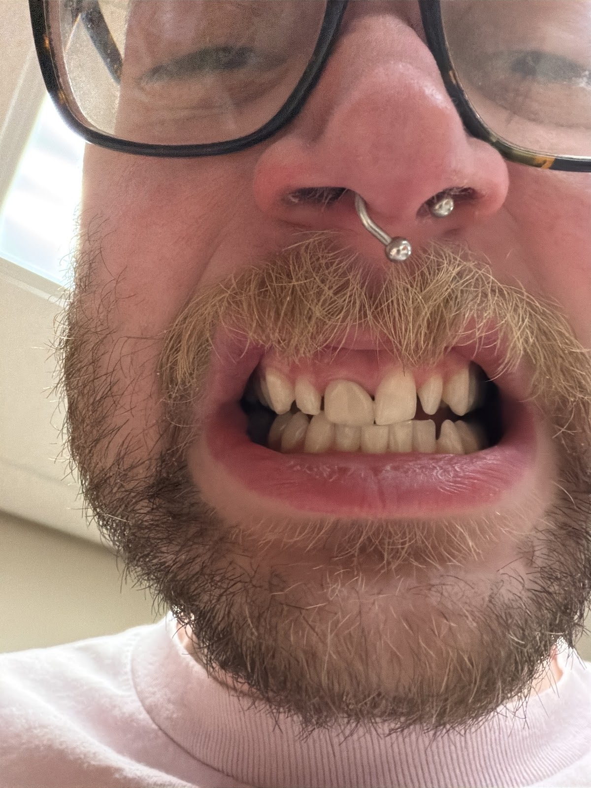 Aspen Dental - Owensboro photo 4