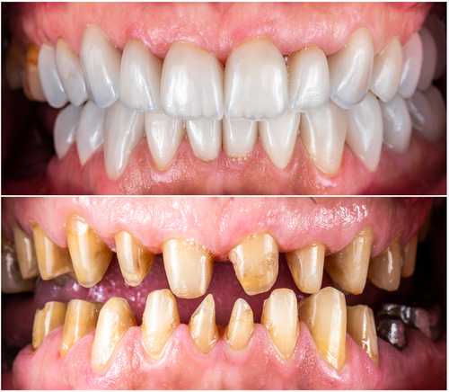 Houston Dental Implants Family Dentistry Oral Surgery And Periodontics photo 2