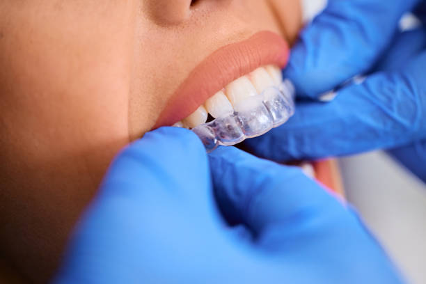 Houston Dental Implants Family Dentistry Oral Surgery And Periodontics photo 3