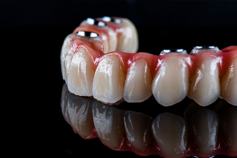 Houston Dental Implants Family Dentistry Oral Surgery And Periodontics photo 5