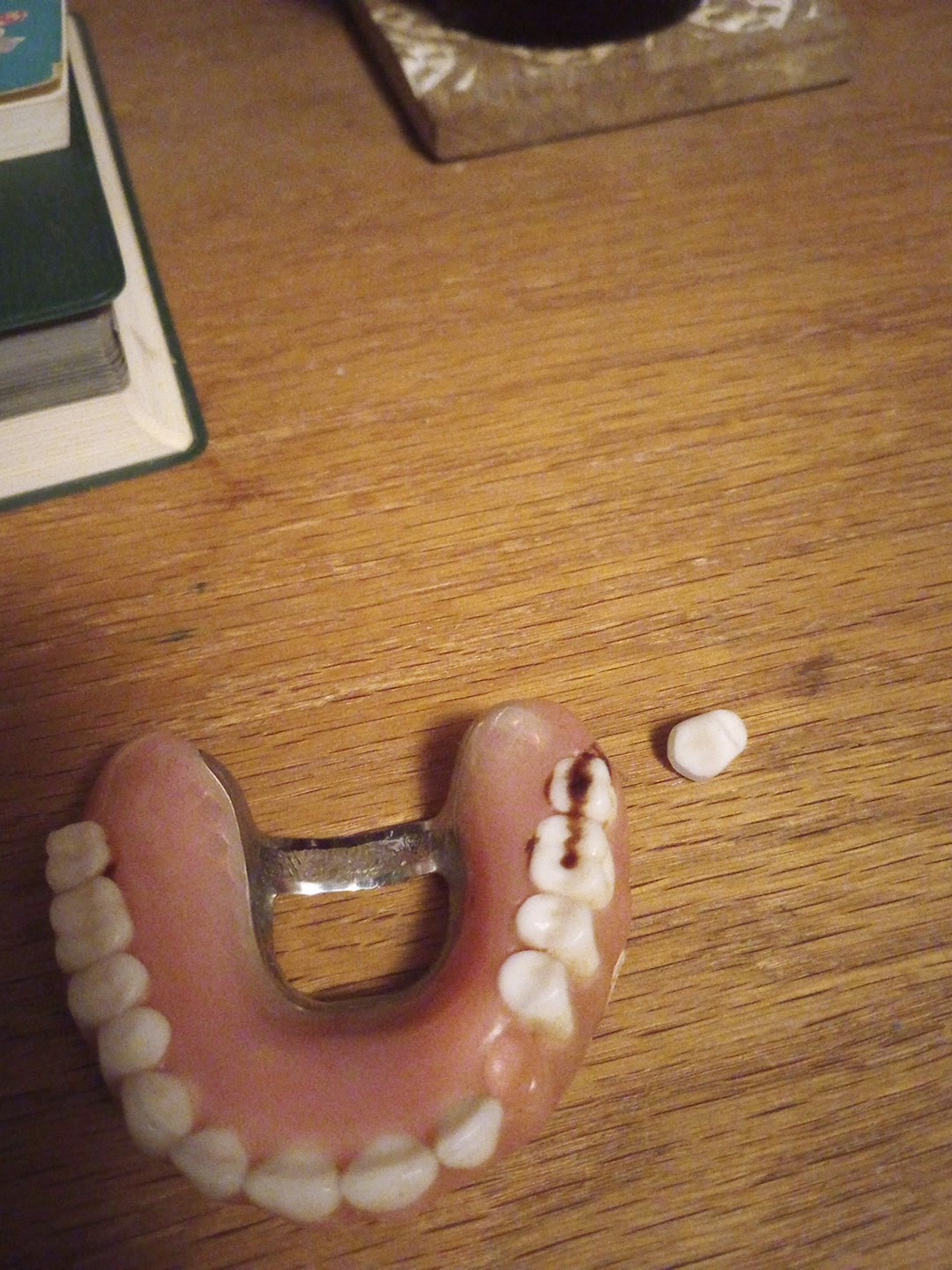 Affordable Dentures & Implants - Bowling Green photo 4