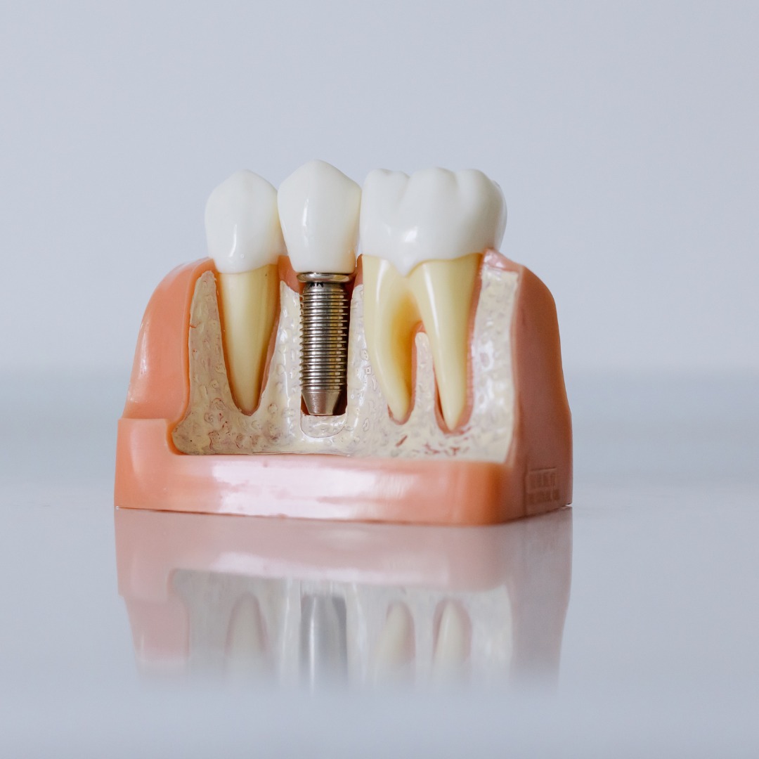 Richard Newhart, DDS photo 2