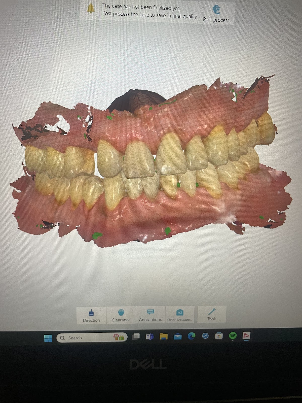 Richard Newhart, DDS photo 6