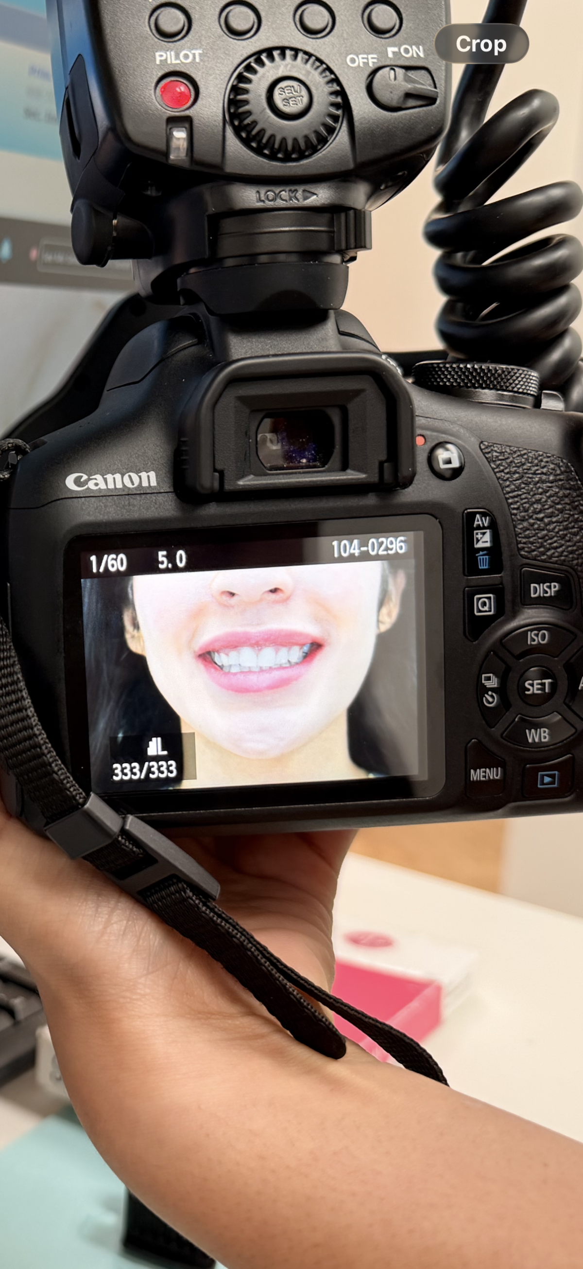 See Me Smile Dental Of Oxnard Dental Office Of Dr.Hamid Barkhordar photo 6