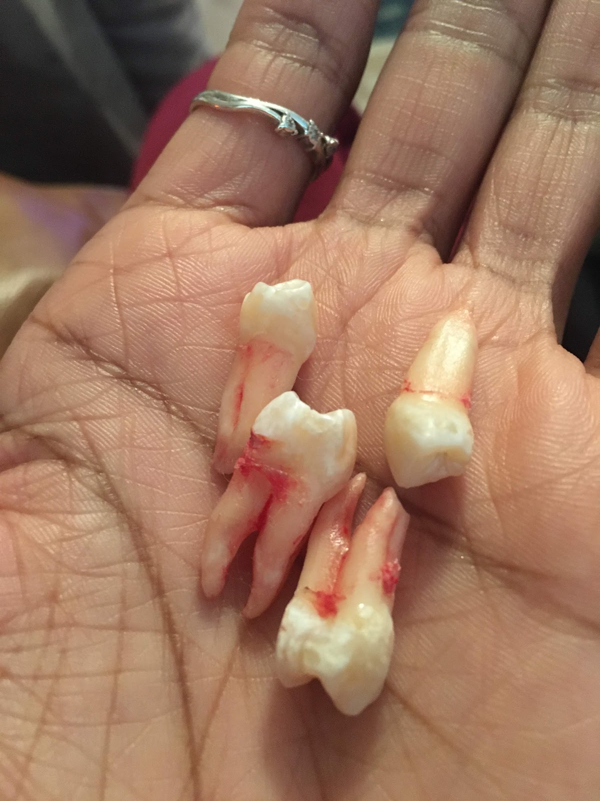 Oral Surgery Associates and Dental Implants Center photo 3