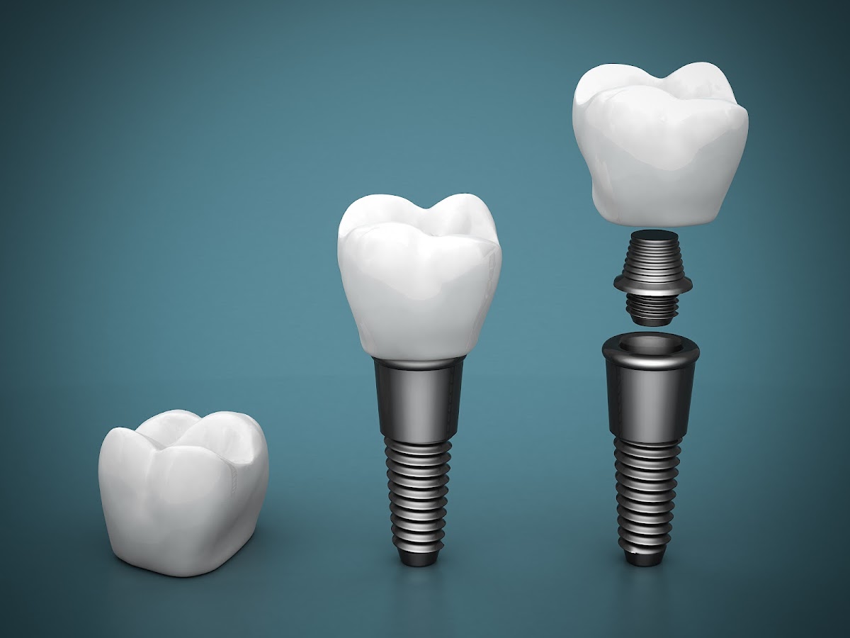 Princeton Oral & Maxillofacial Surgery | Dental Implant Center photo 3