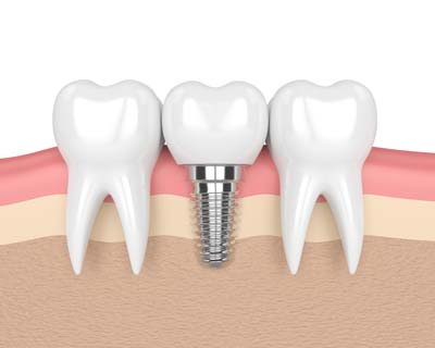 Twin City Dental photo 2