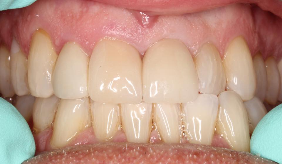 La Mesa Smiles & Implant Dentistry photo 1