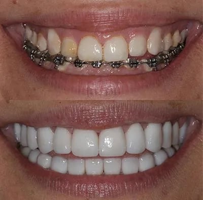 Joseph D'angelo & Ashley Olson, La Jolla Dentists photo 3