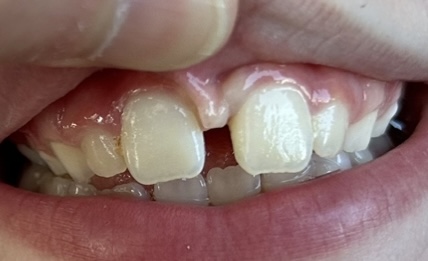 Rosewood Periodontics & Dental Implants (albany and Dallas, Or) photo 4