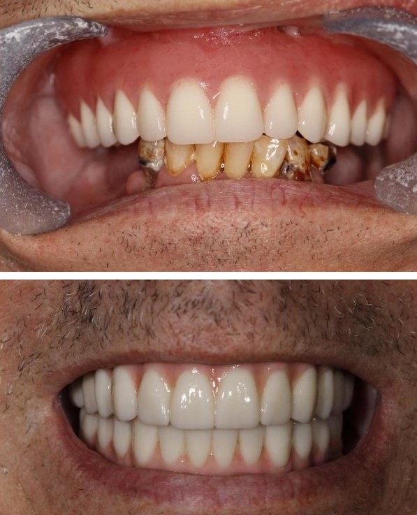 Care First Dental Team photo 3