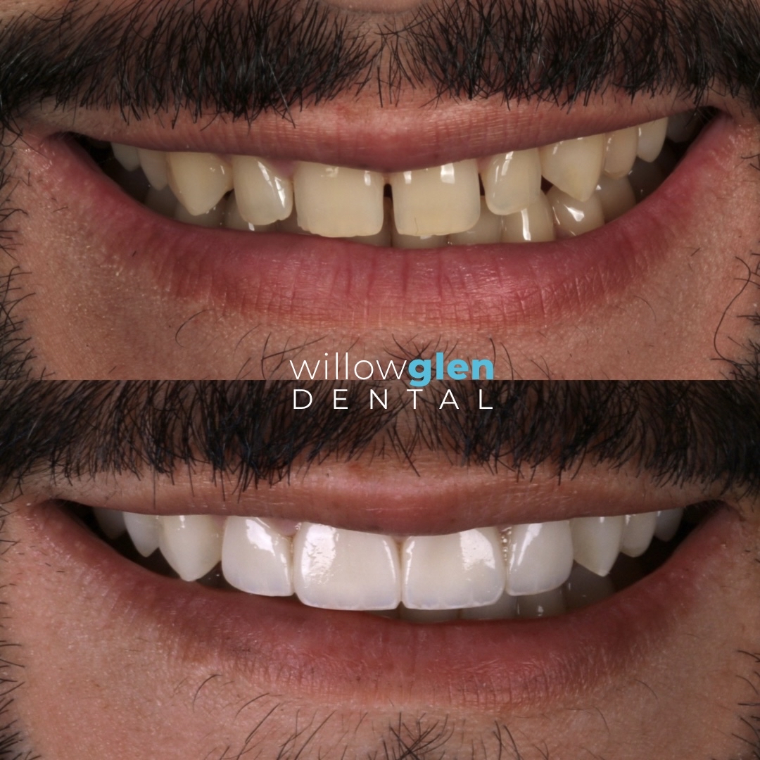 Willow Glen Dental photo 2