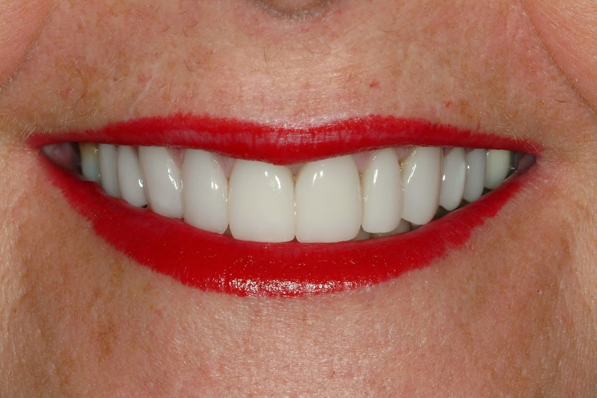 Meadowlark Dental Associates - Kearney, Ne photo 1