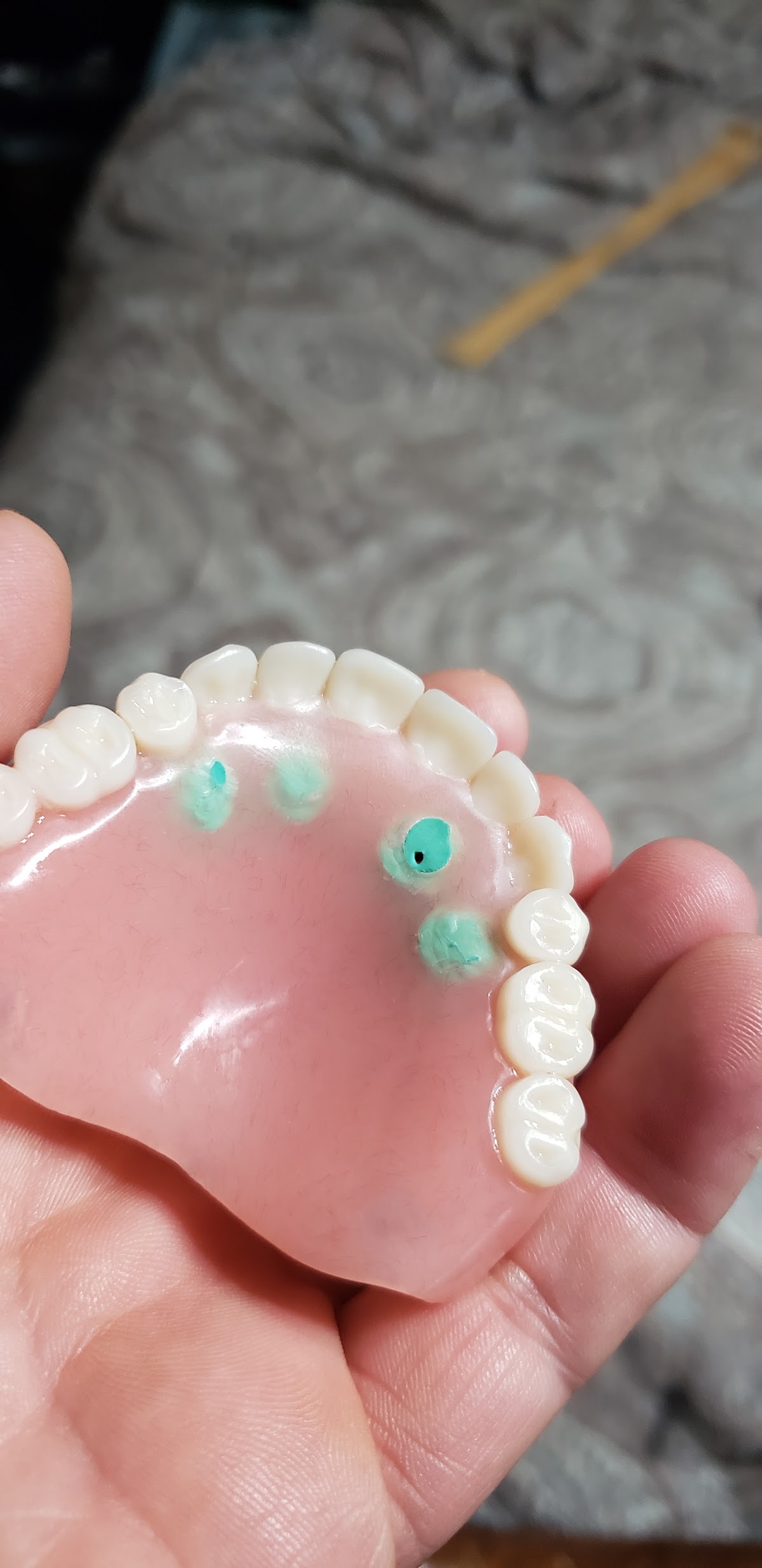 Bay Area Denture Center photo 3