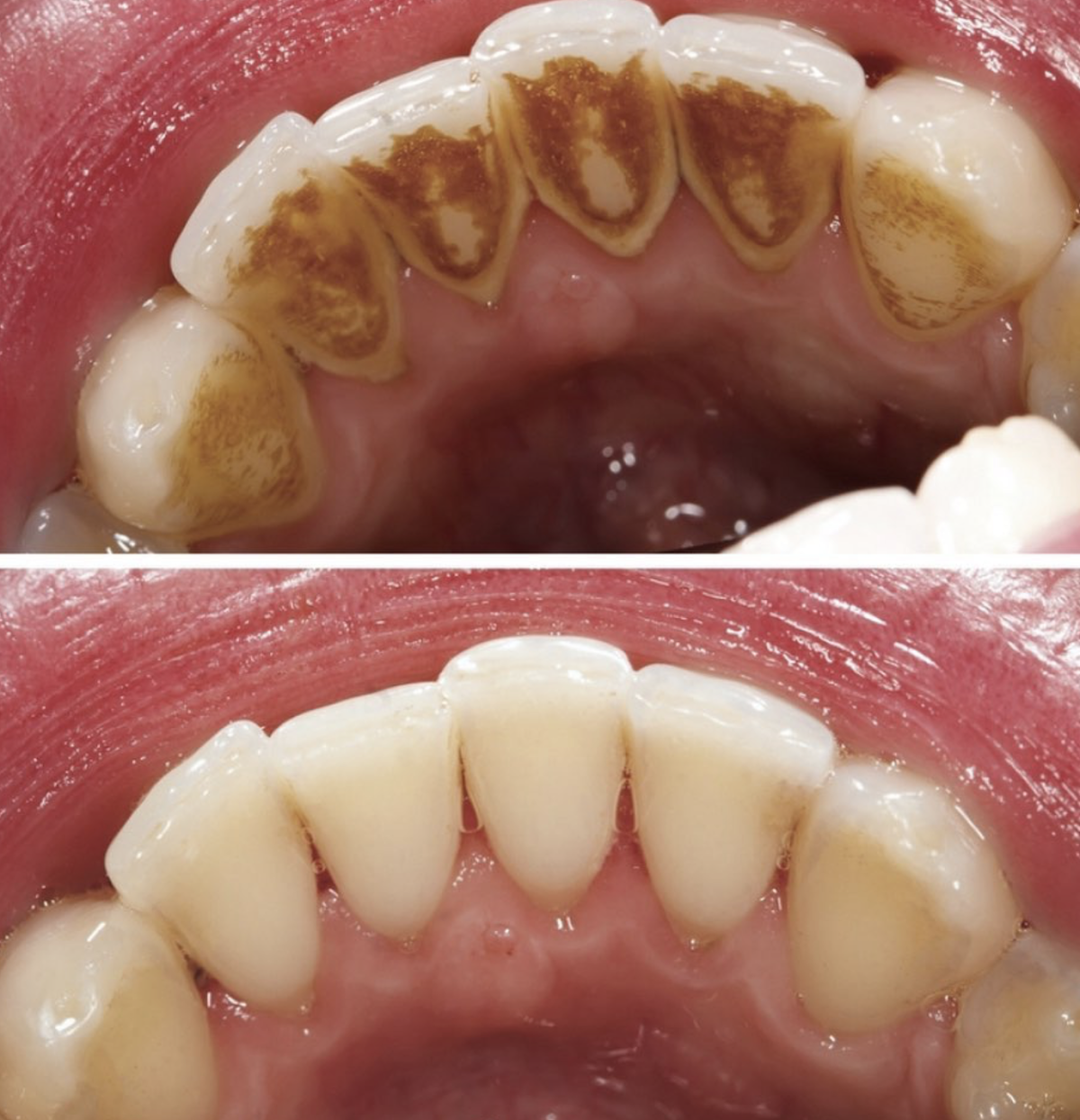 Apple Family Dental Longview, Wa photo 3