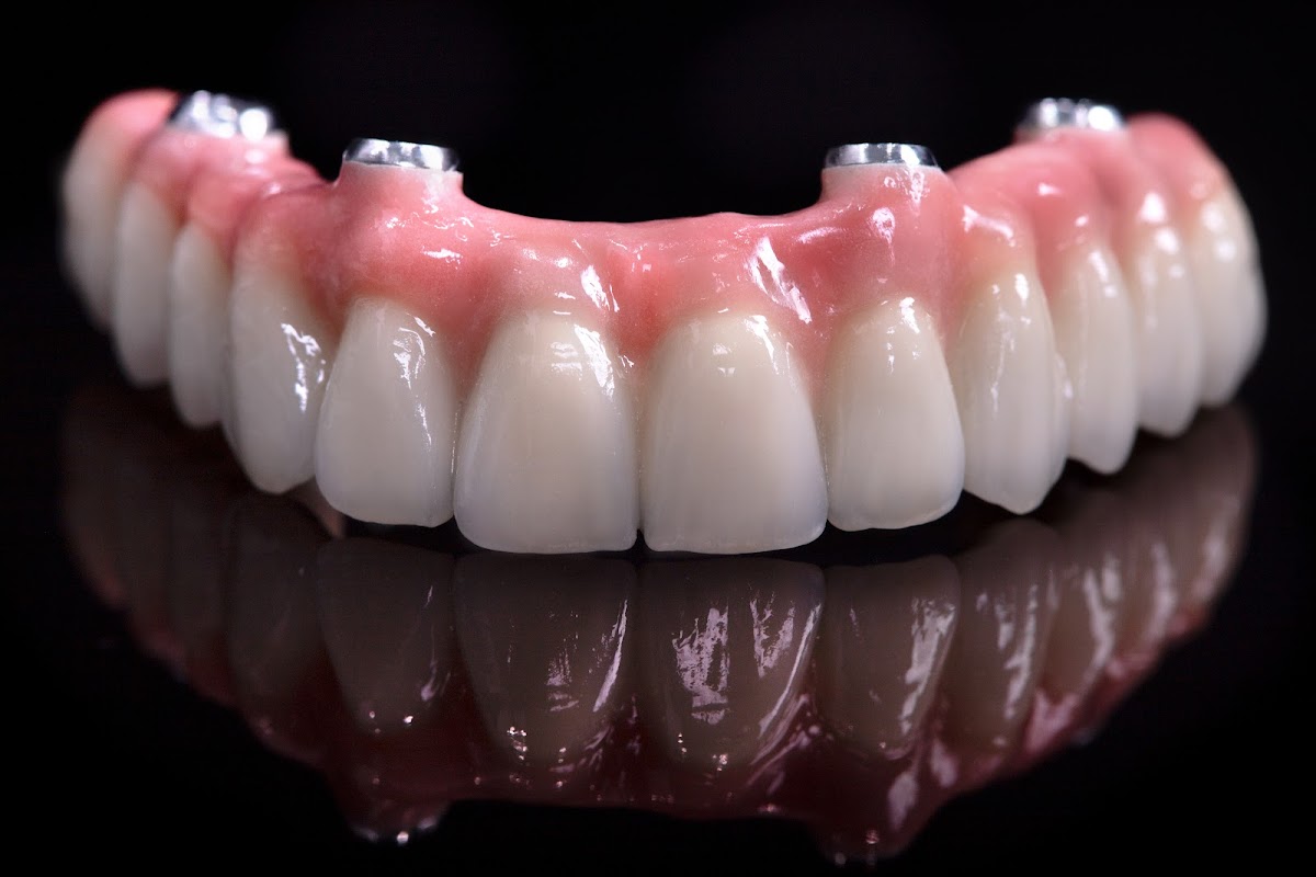 Asbury Dental & Implants Center - Dental Implants St. Augustine &st. Johns County photo 4