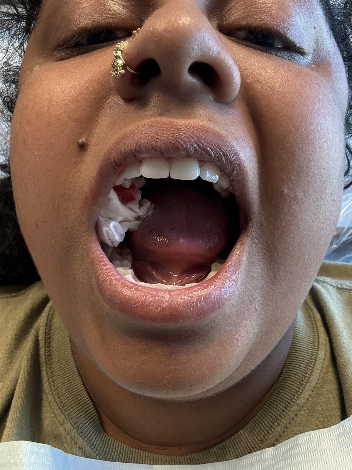 Sf Bay Oral Surgery & Dental Implants (Drs. Sy, Hui And Hall) photo 5