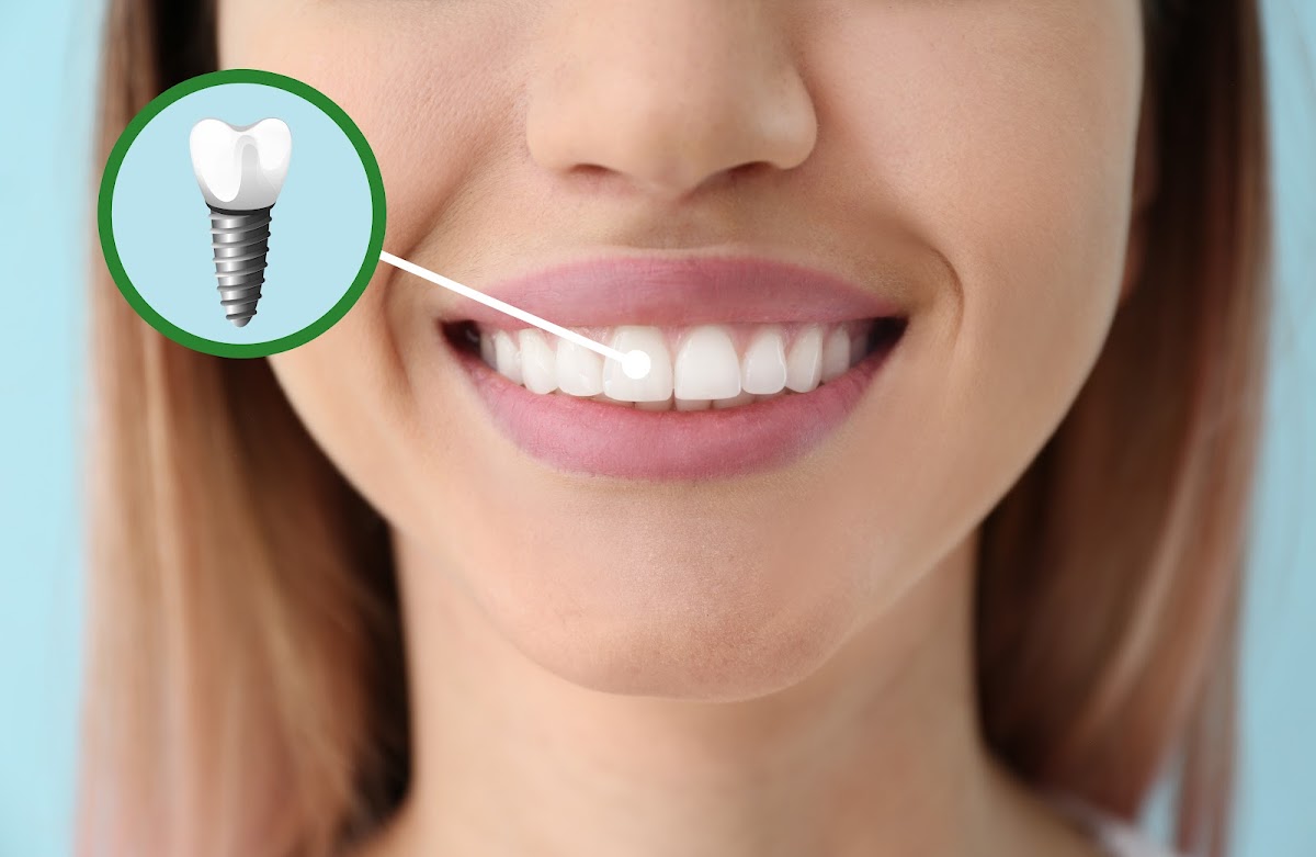 The Dental Implant Center photo 3