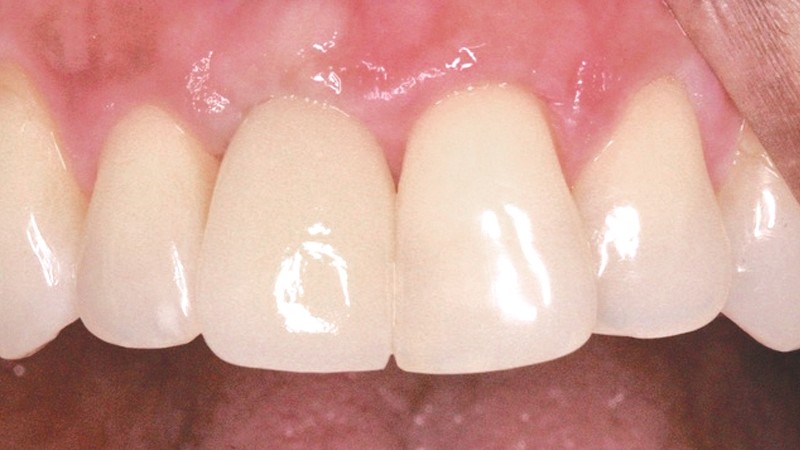 Advanced Dental Design - Dr. Ron Walkup DDS photo 2