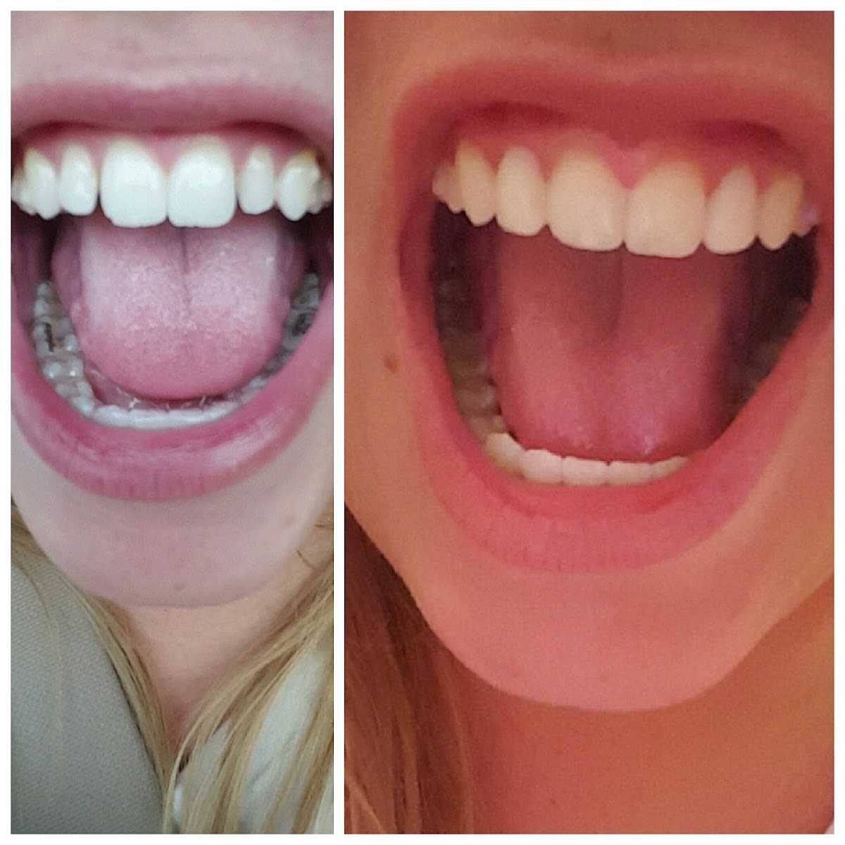 Hidden Creek Dental Care photo 6