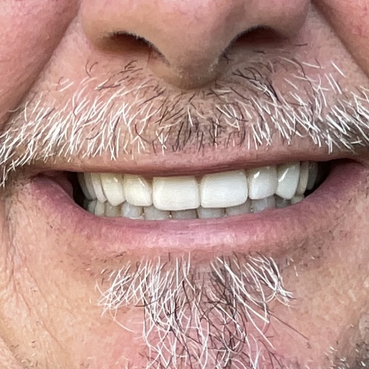 Dr. Sam's Premier Dentistry photo 5