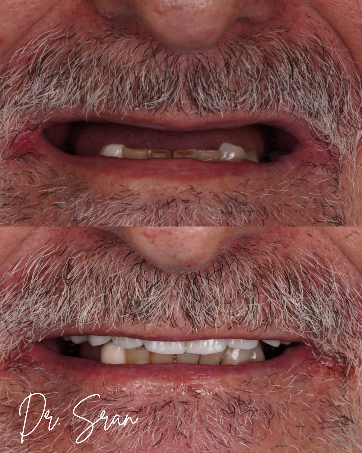 Stratford Dental Implant Center: Dr. Sran photo 1