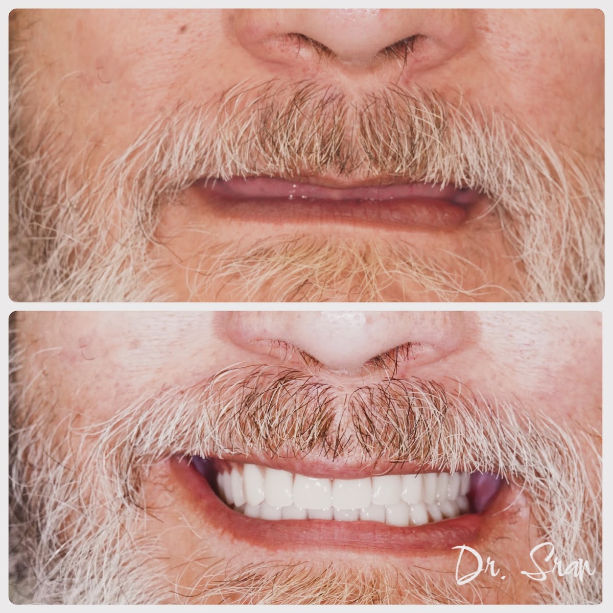 Stratford Dental Implant Center: Dr. Sran photo 2