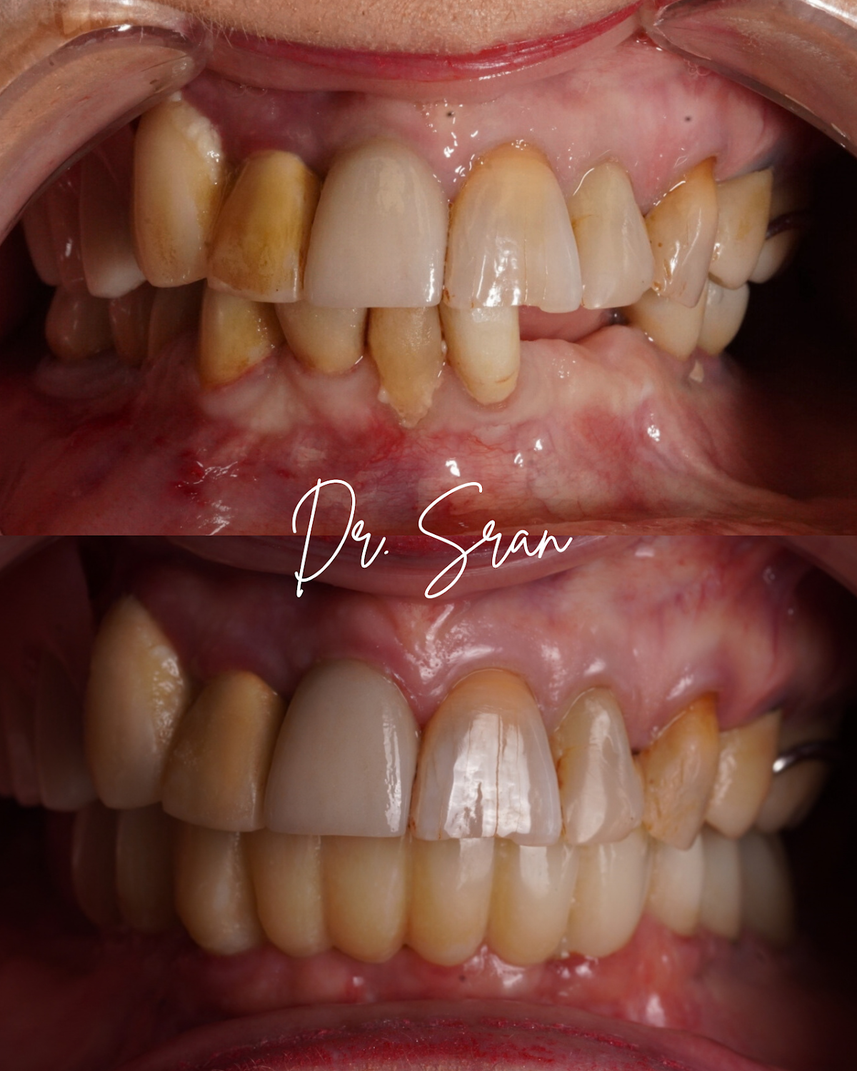 Stratford Dental Implant Center: Dr. Sran photo 3