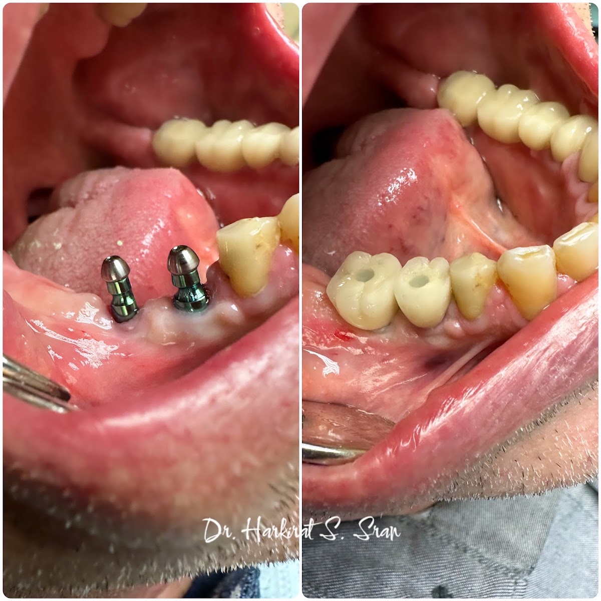 Stratford Dental Implant Center: Dr. Sran photo 4