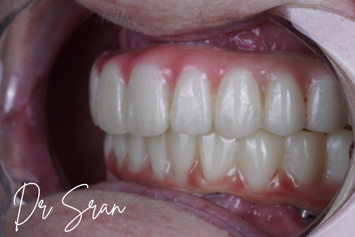 Stratford Dental Implant Center: Dr. Sran photo 5