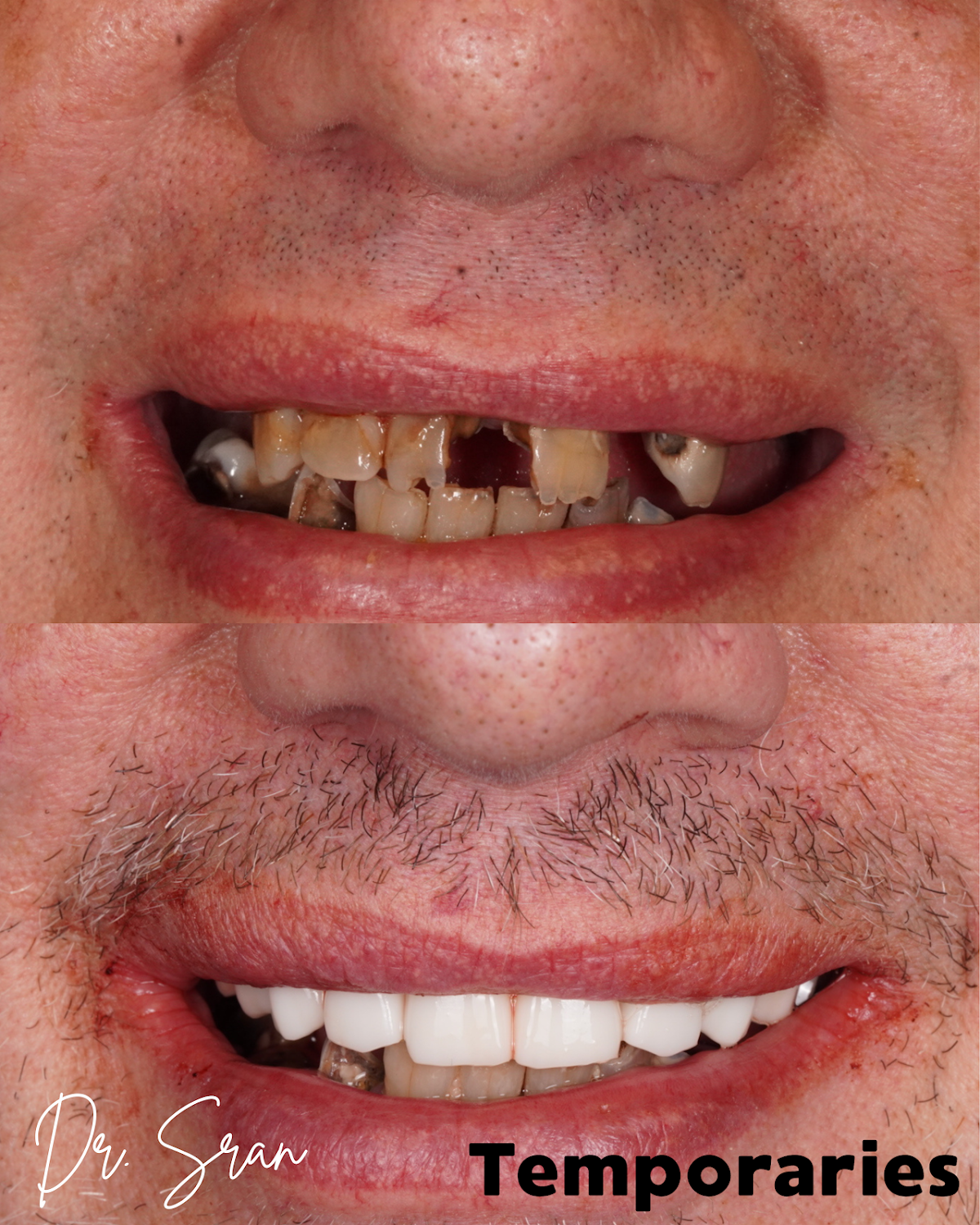 Stratford Dental Implant Center: Dr. Sran photo 6