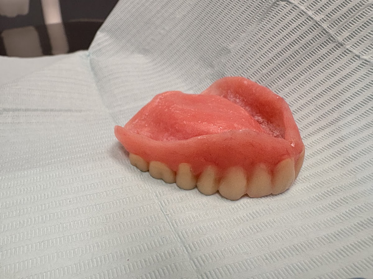 Affordable Dentures & Implants - Vero Beach photo 3