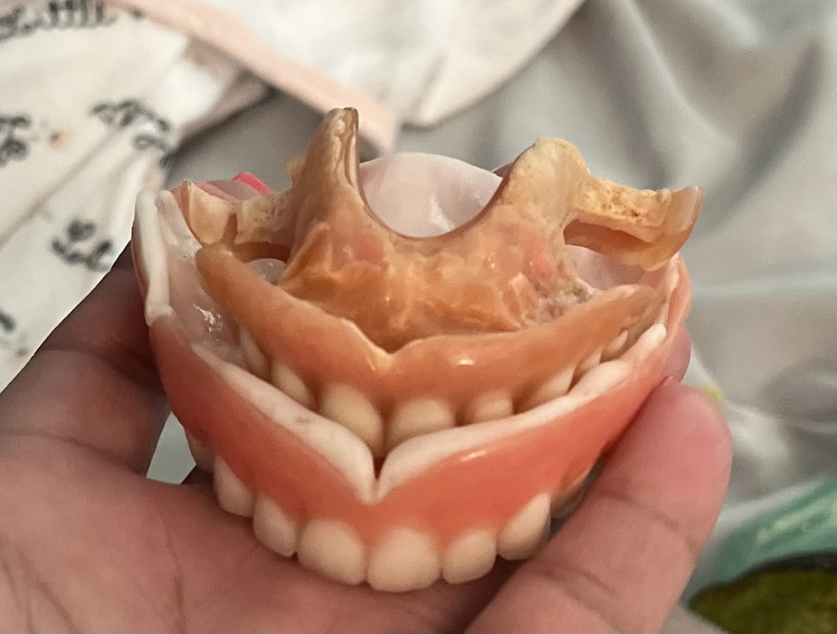Affordable Dentures & Implants - Vero Beach photo 5