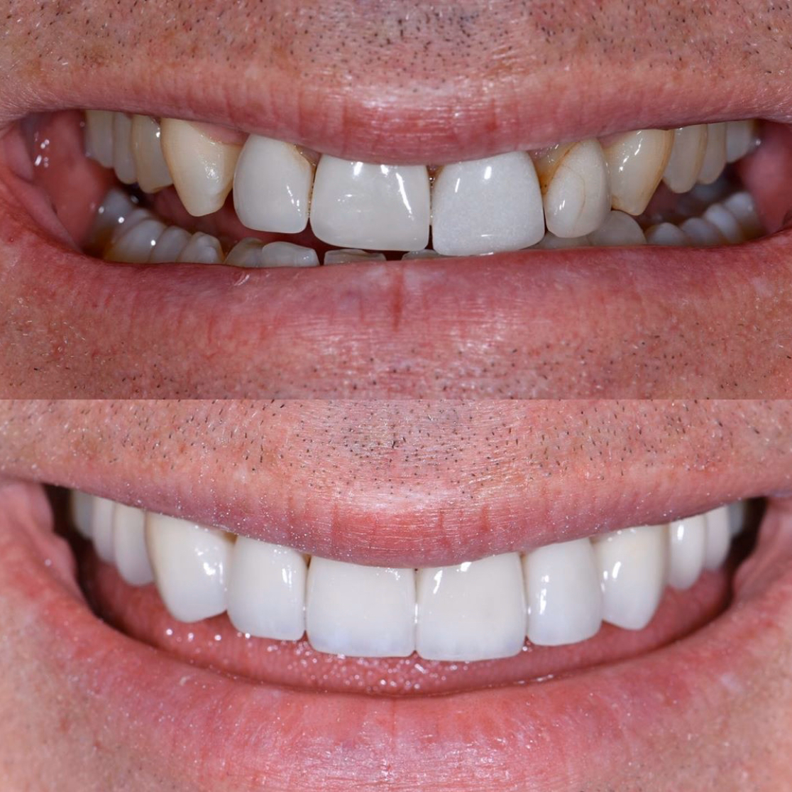 Allure Dental Chicago - Michigan Ave photo 5