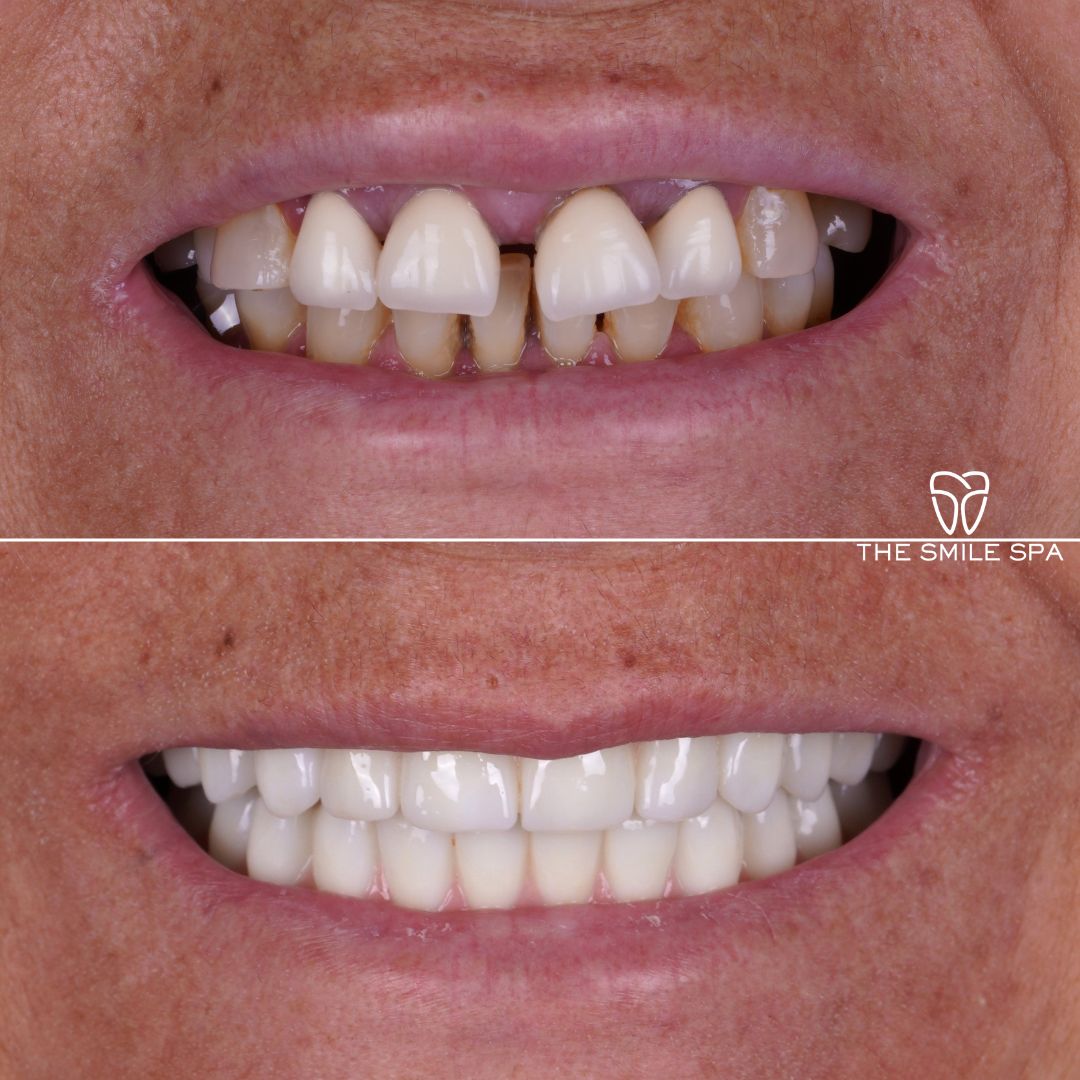 Agoura Hills Dental Implants photo 4