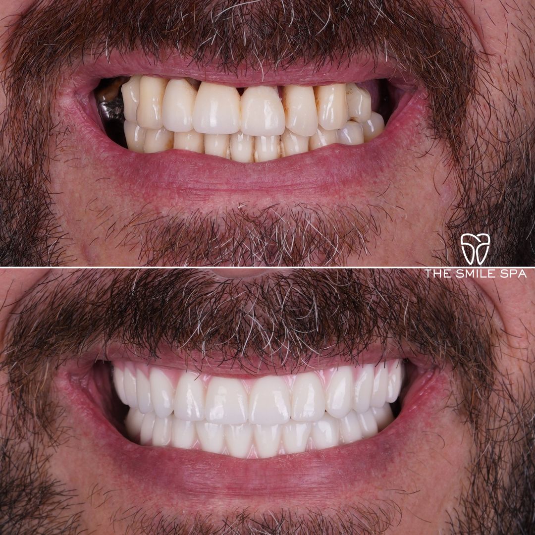 Agoura Hills Dental Implants photo 5