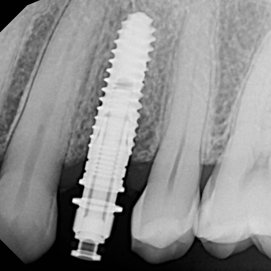 Agoura Hills Dental Implants photo 6