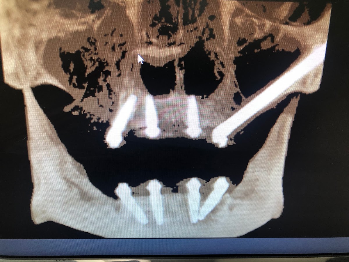 Sd Oral Surgery photo 4