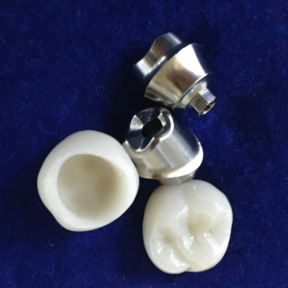 Harrison Implant and Family Dentistry photo 5