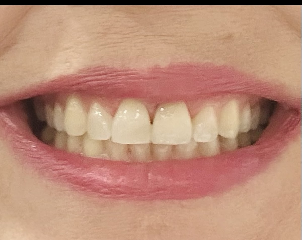 Palm Bay Dental Center photo 6