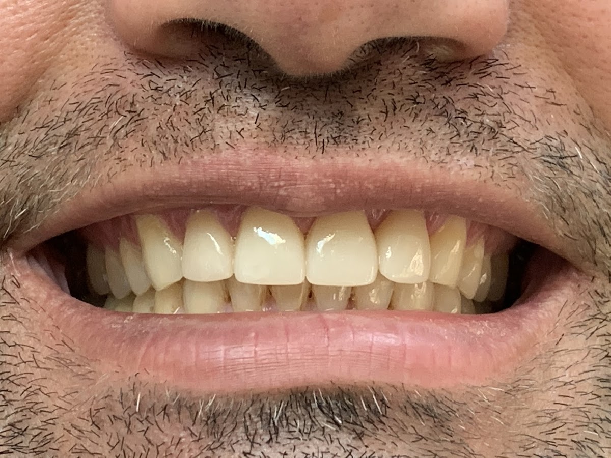 Albert M. Tsang Dds - Pinole General And Implant Dentistry photo 4